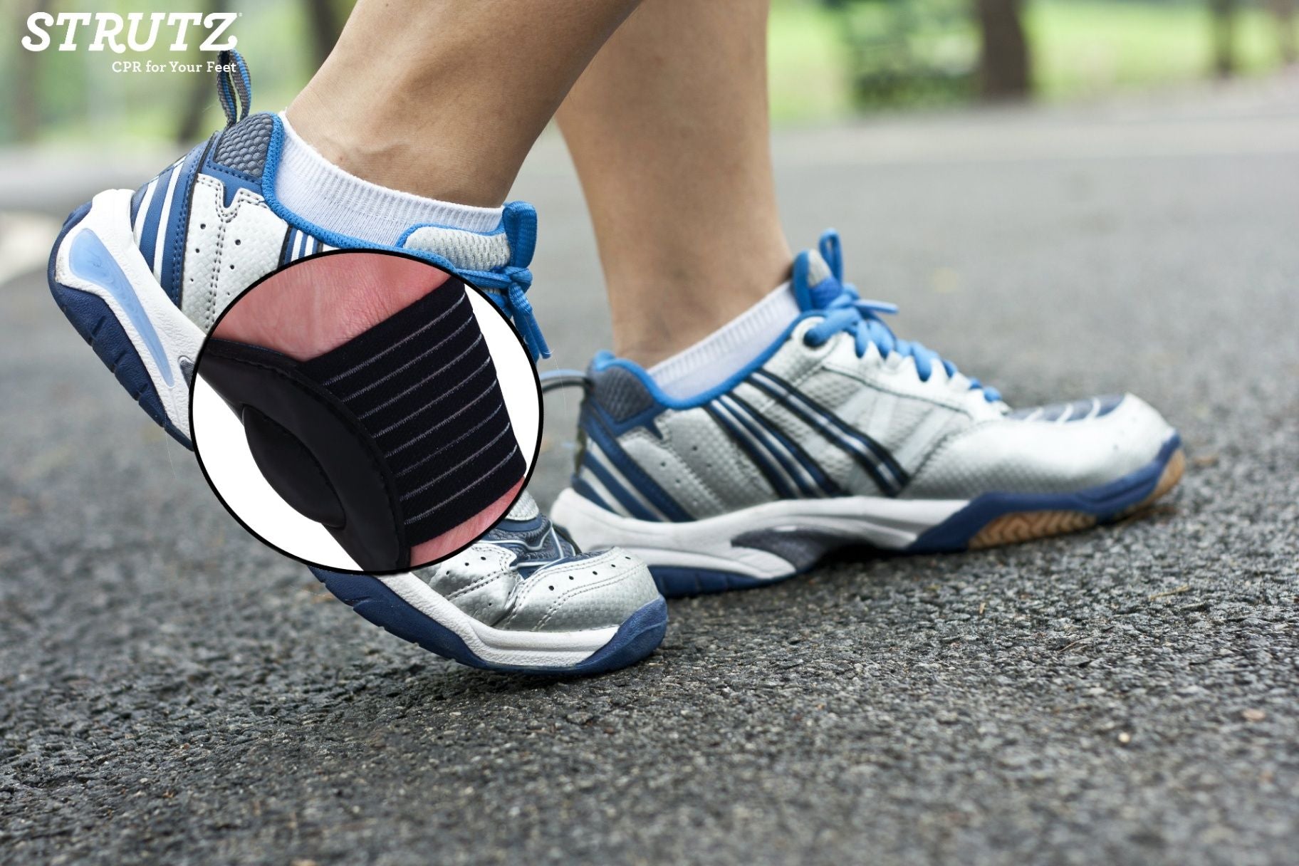 Why Your Summer Shoes Are Ruining Your Arches (And How to Fix It Fast)
